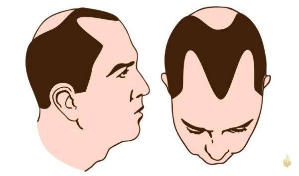 دراسة جديدة تبشر بعلاج تساقط الشعر