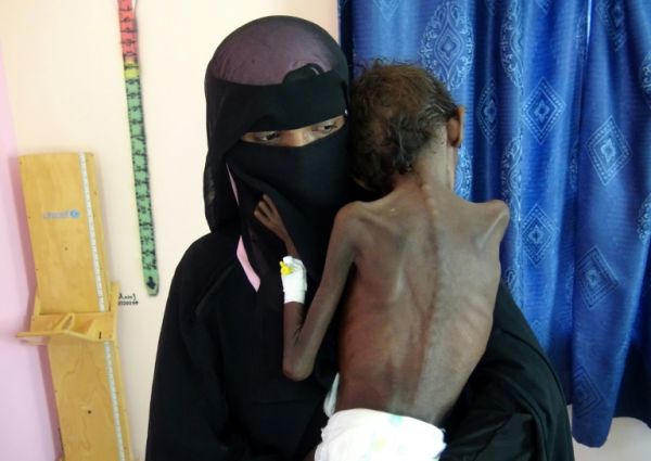 الحكومة: ارتفاع نسبة الفقر في اليمن 80% وانكماش الاقتصاد 50%