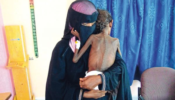 منظمة ألمانية تدعو لتحسين وصول المساعدات للمتضررين في اليمن