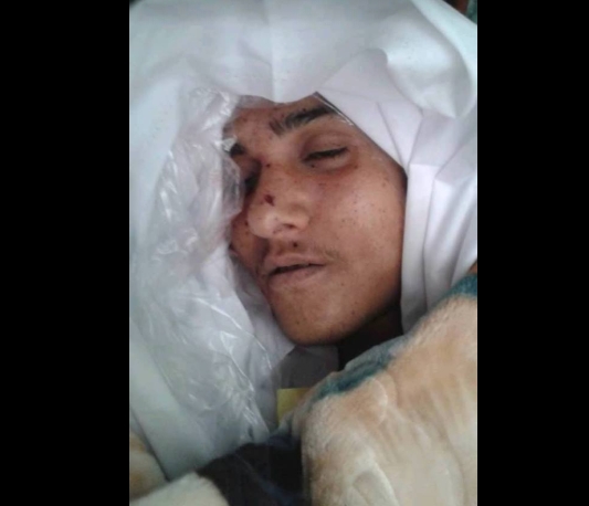 مقتل شاب برصاص قناص حوثي في تعز
