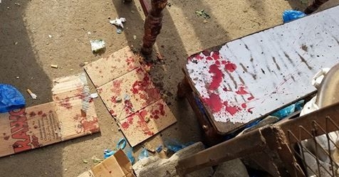 مقتل واصابة 9 مدنيين إثر انفجار عبوة ناسفة وسط مدينة تعز