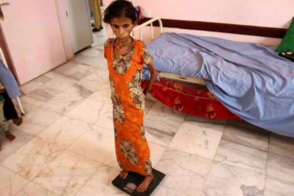 ثمانية أطفال يقتلون أو يصابون في اليمن كل يوم رغم الهدنة
