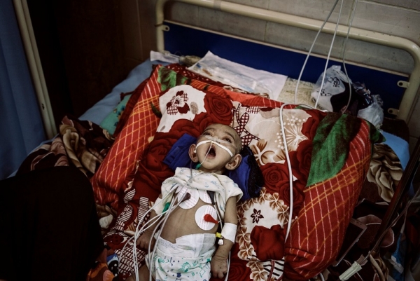 مصور ايطالي يفوز بجائزة "بوليتزر" لصور التقطها من حرب اليمن (ترجمة خاصة)