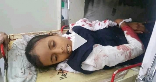 ضحايا أطفال في قصف للحوثيين بتعز