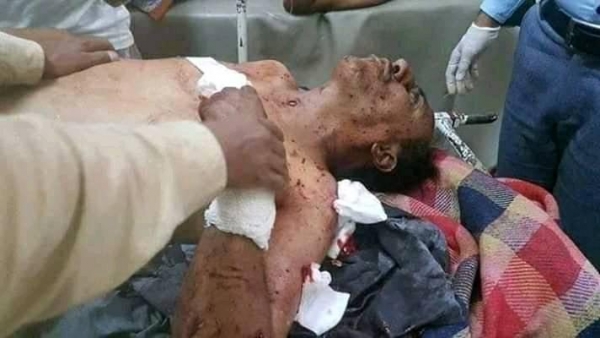 مقتل طفل واصابة والده بانفجار قنبلة أطلقها مسلحو ابو العباس في تعز