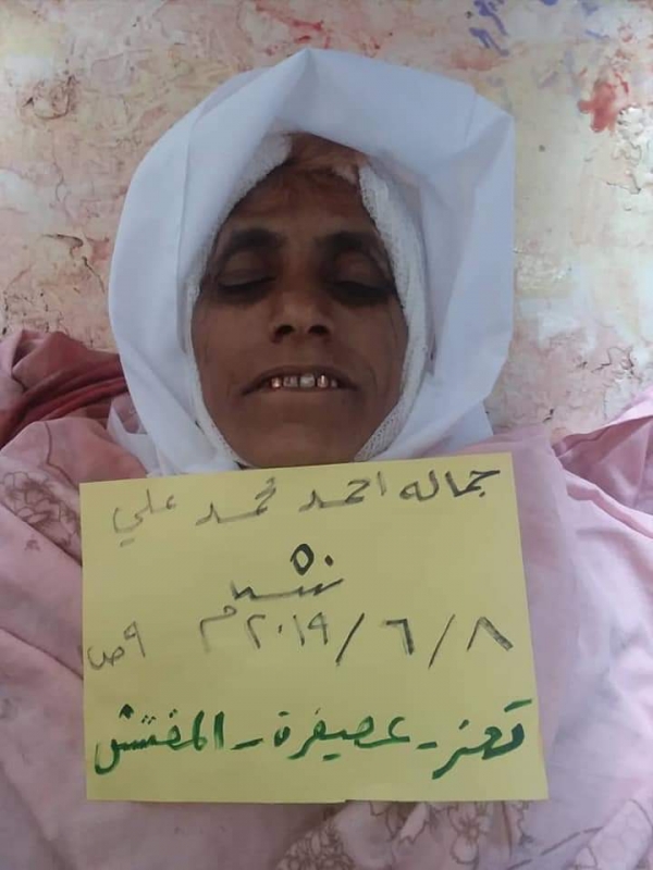 مقتل امرأة وإصابة شقيقتها برصاص قناص حوثي في تعز