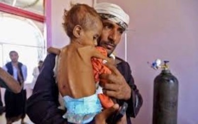 الصليب الأحمر: 3.2 ملايين طفل وامرأة في اليمن يعانون من سوء التغذية الحاد