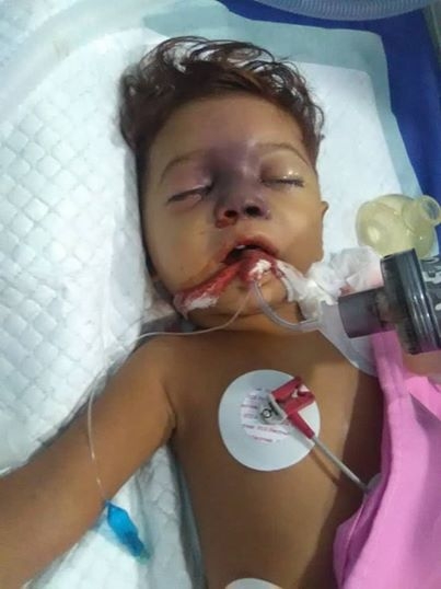 وفاة طفلة في الحديدة بسبب عجز والديها عن إسعافها