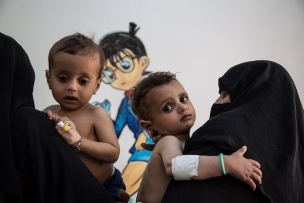 الصحة العالمية تعلن ولادة 4 ملايين طفل خلال سنوات الحرب في اليمن