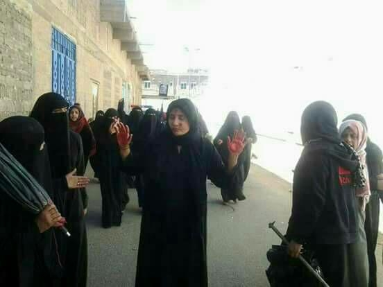 الحكومة: جماعة الحوثي تواصل اعتقال 320 امرأة