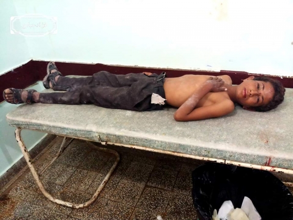 إصابة مواطنين بينهم طفل بانفجار لغم زرعته جماعة الحوثي في الضالع