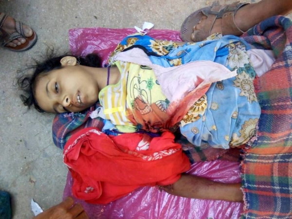 الأمم المتحدة: وفاة طفل تحت سن الخامسة كل 12 دقيقة باليمن‎