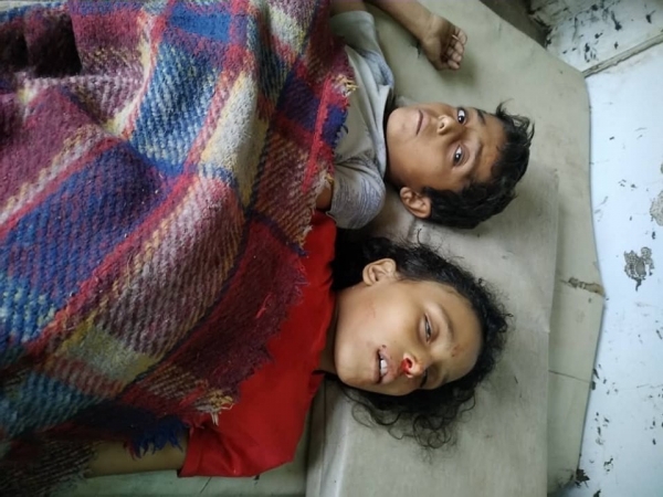 تعز.. مقتل طفلة وإصابة أربعة آخرين بقصف حوثي استهدف قرى سكنية