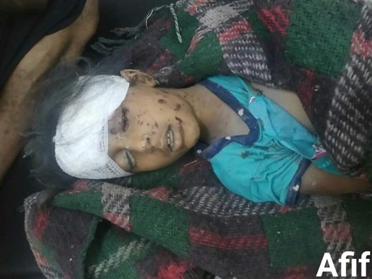 ناشطون يمنيون يطلقون حملة إعلامية للتنديد بانتهاكات الحوثيين بحق أطفال اليمن