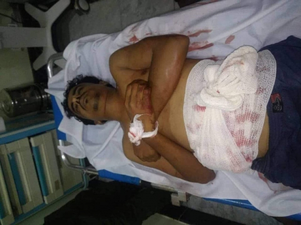 مقتل شاب برصاص أحد أفراد الانتقالي في عدن