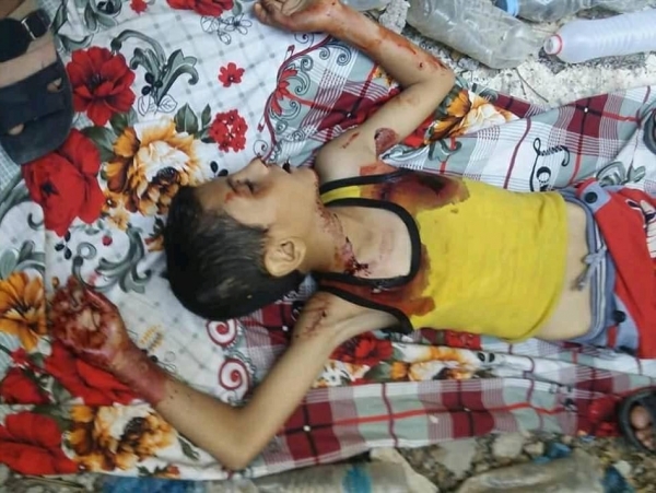 مقتل طفل وإصابة شقيقه برصاص قناص حوثي في تعز