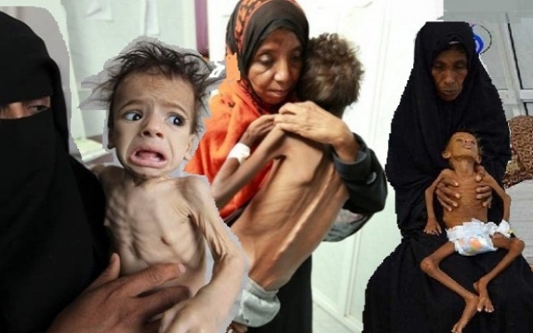 الصليب الأحمر: 66 بالمئة في اليمن لا يملكون الطعام