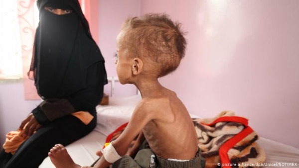 تحذير أممي من مجاعة وشيكة في اليمن