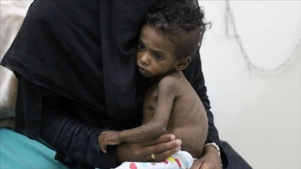 مسؤول أممي: 10 ملايين يمني على بعد خطوة من المجاعة