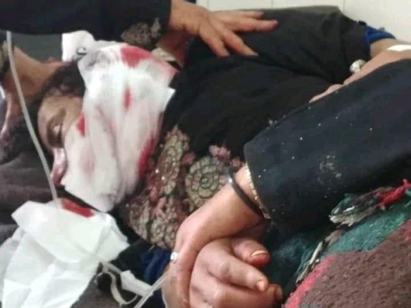 إصابة امرأة برصاص قناص حوثي في تعز