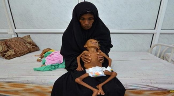 حذرت من زيادة نسبة المجاعة.. أوكسفام: ملايين اليمنيين يكافحون للنجاة