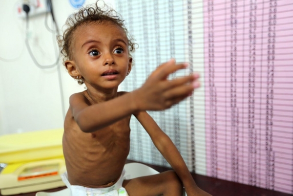 المجلس النرويجي يُحذر من ارتفاع عدد الجياع في اليمن خلال الأشهر المقبلة