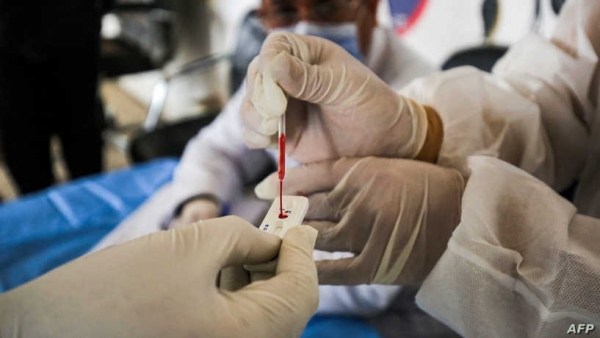 اليمن.. تسع حالات وفاة بفيروس كورونا و42 إصابة جديدة