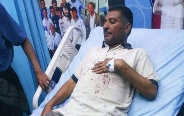 نقابة الصحفيين تدين الاعتداء على الصحفي محمد العزيزي بصنعاء
