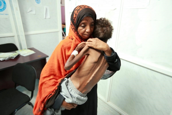 الأورومتوسطي: 100 ألف قتيل في اليمن منذ بدء الحرب