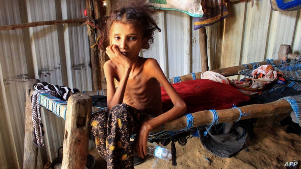 برنامج الغذاء يحذر من ذهاب 16 مليون يمني نحو المجاعة