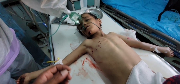 الأمم المتحدة: أكثر من 2500 طفل قتل أو تشوه بسبب الحرب في اليمن خلال العامين الماضيين