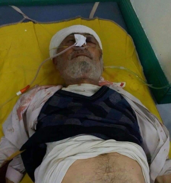 مقتل رجل مسن برصاص قناص حوثي في تعز