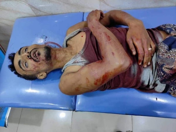 مليشيا الانتقالي تقتل مواطنين اثنين في عدن