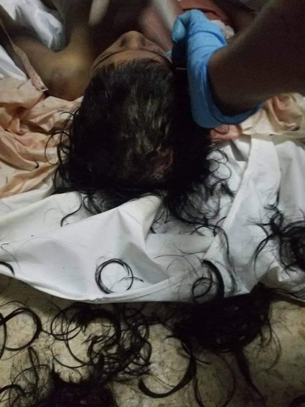 مقتل طفلة في إب بظروف وملابسات غامضة وسط تصاعد جرائم العنف الأسري