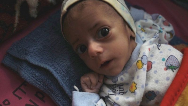 الحرب في اليمن: مأرب تعيش مأساة إنسانية في ظل 