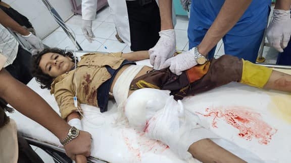 مقتل وإصابة 28 مدنيا بقصف للحوثيين استهدف حي المطار بمدينة مأرب "صور"
