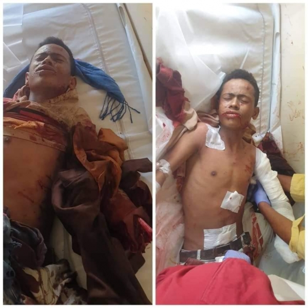 إصابة أربعة مدنيين بينهم طفلان بمقذوف حوثي شرقي تعز
