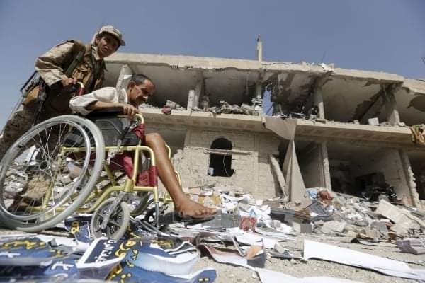 المنظمة الدوليّة: 4,8 مليون معاق يعاني من هشاشة وضعهم باليمن