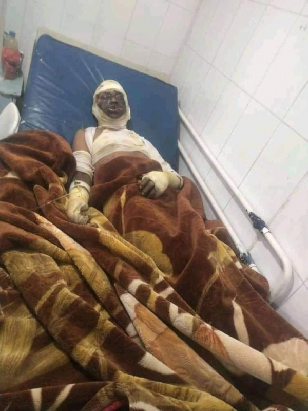إب.. وفاة مواطن بعد إضرام النار في جسده أمام إدارة أمن مديرية العدين