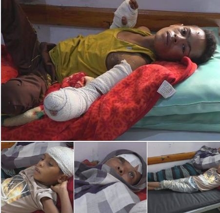 رابطة حقوقية: مقتل 5700 طفل باليمن منذ انقلاب جماعة الحوثي