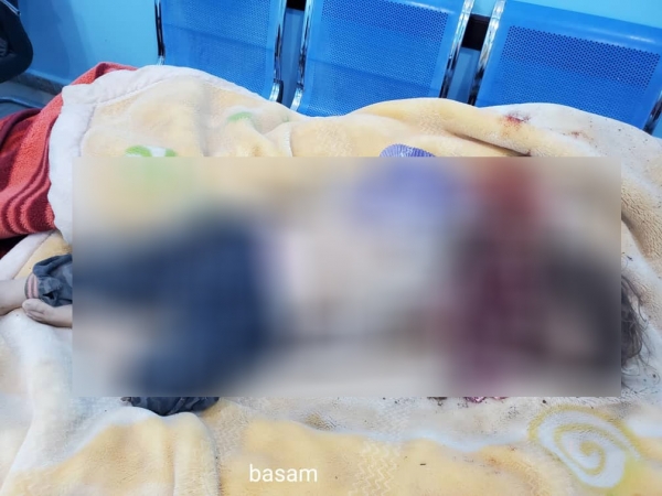 9 قتلى وجرحى بينهم أطفال في مخيمات النازحين بمدينة مأرب جراء قصف حوثي 