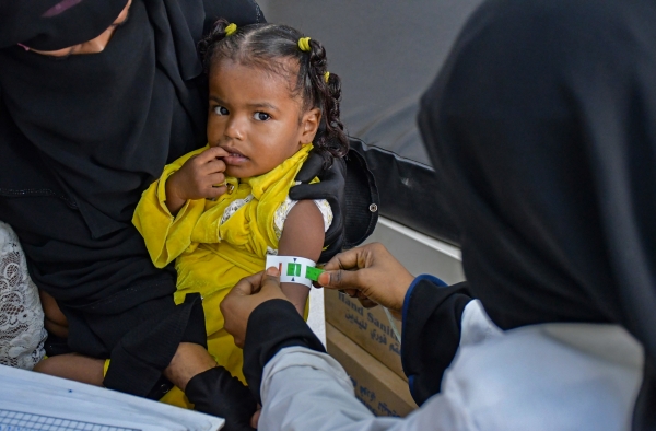 أطباء بلا حدود تعلن ارتفاع معدل سوء التغذية بين الأطفال 36 بالمئة في اليمن