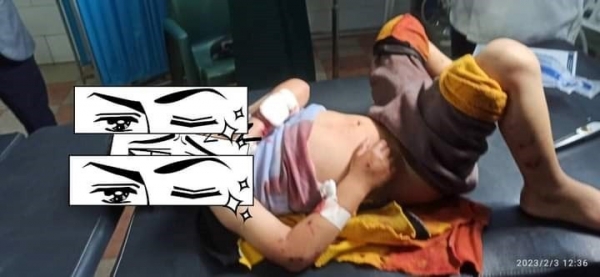 إصابة طفل وامرأتين بجروح بليغة بتفجير قنبلة في محافظة إب