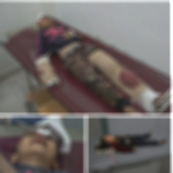 تعز.. إصابة طفلين جراء قصف حوثي استهدف حي 