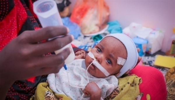 "يونيسف" تحذر من تعرض ملايين الأطفال في اليمن لسوء التغذية