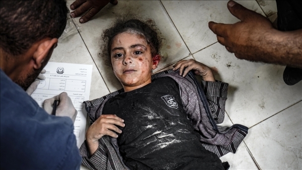 منظمة دولية: نحو 10 أطفال يفقدون سيقانهم يوميا بغزة
