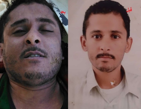 جراء التعذيب.. وفاة مختطف في سجون الحوثيين بعد 7 سنوات من إعتقاله