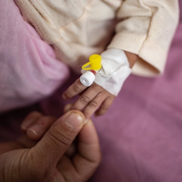 يونيسف: 600 ألف طفل في اليمن يعانون من الحالات الحادة الوخيمة