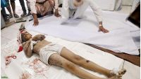الأمم المتحدة تدين قصف ميليشيا «الحوثي» المدنيين في تعز