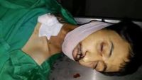 منظمة عربية: الحوثيون وصالح يمارسون "تعذيبا ممنهجا وحشيا" في سجونهم
